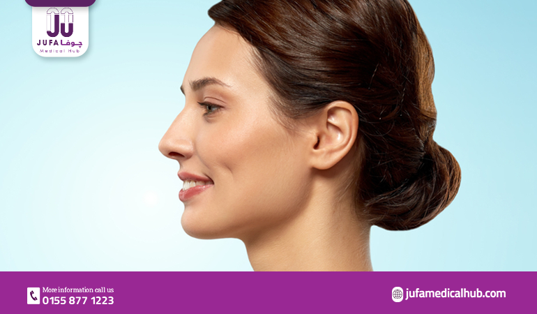 Dimples image